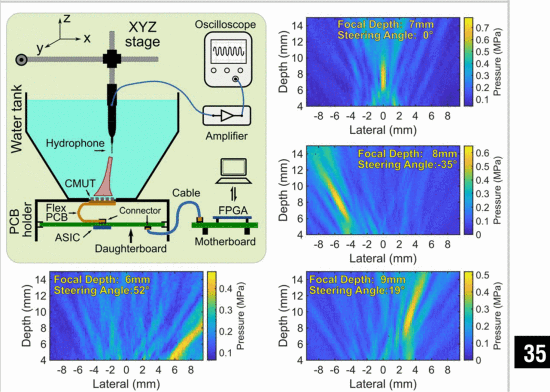 A Single-Inductor-Based High-Voltage Transmit Beamformer for Wearable Ultrasound Devices Achieving 88 fCV sup 2 sup Power Reduction